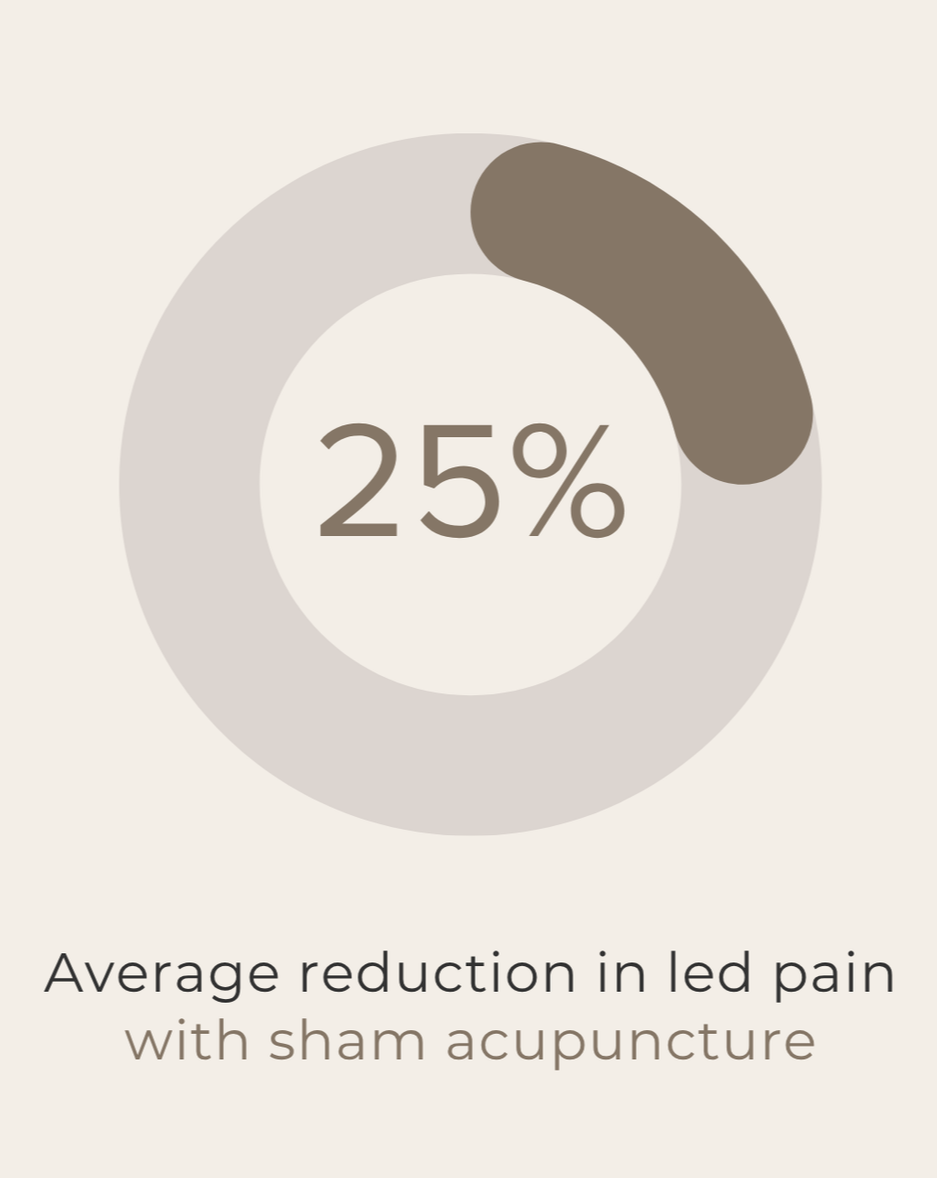 Sham acupuncture reduced average leg pain by 25% in a clinical trial of adults with sciatica