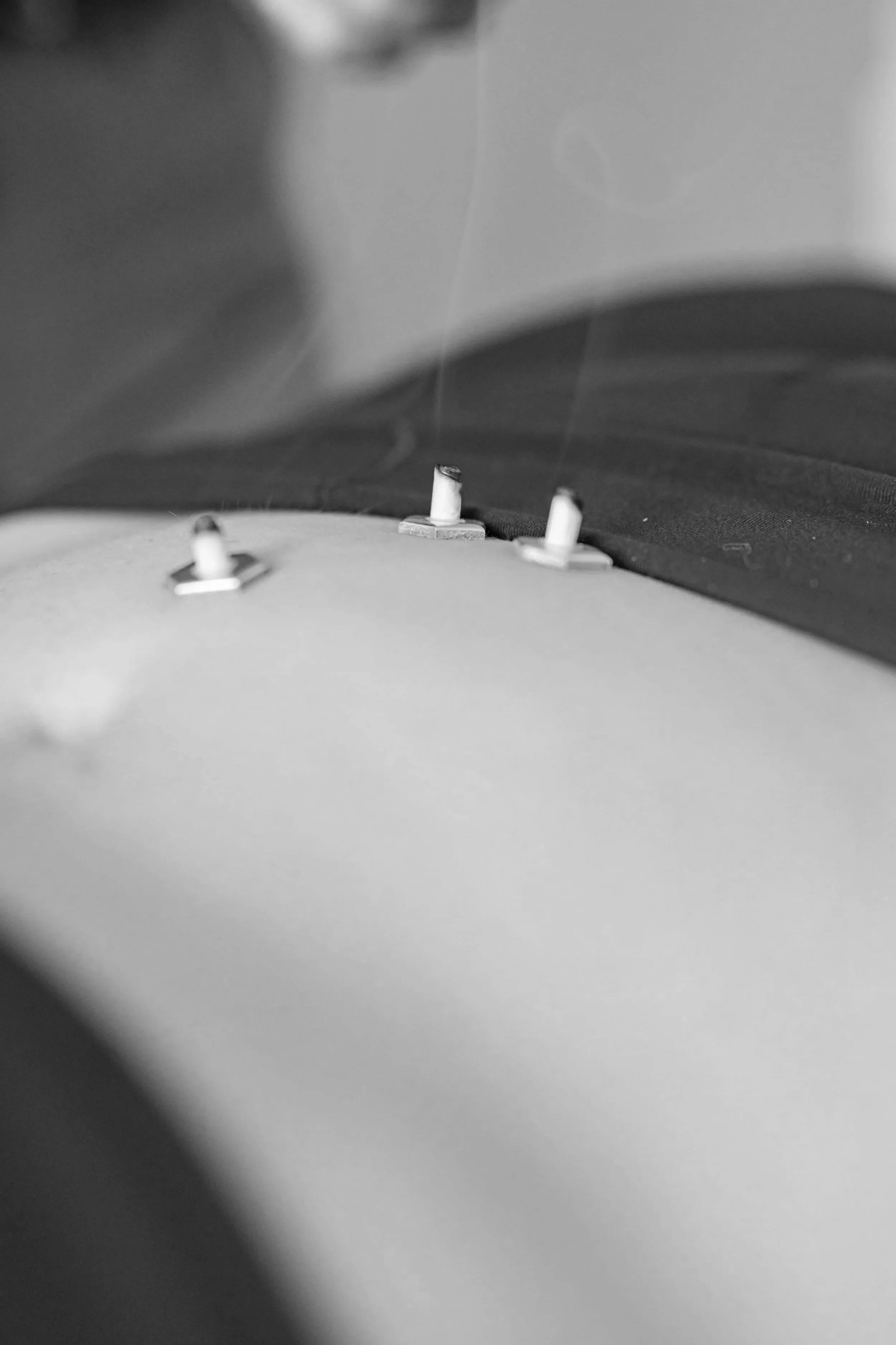 Acupuncture treatment supporting egg freezing at The Violette House in Groton, MA