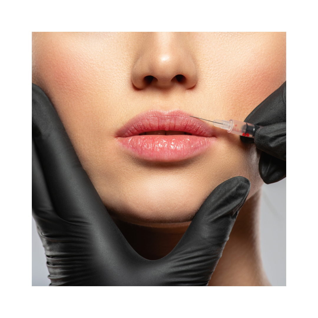 Dermal Fillers