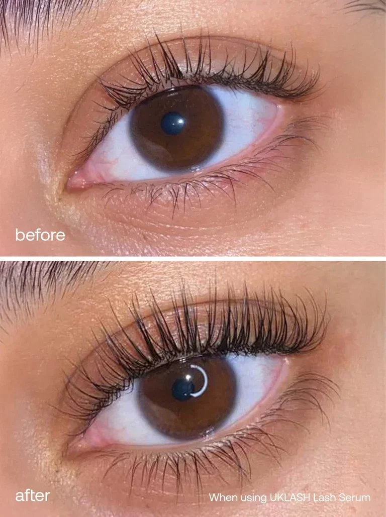 lash-growth-serum-eyebrow-growth-serum-set-uklash-uklash-ukbrow-set-1130683.webp