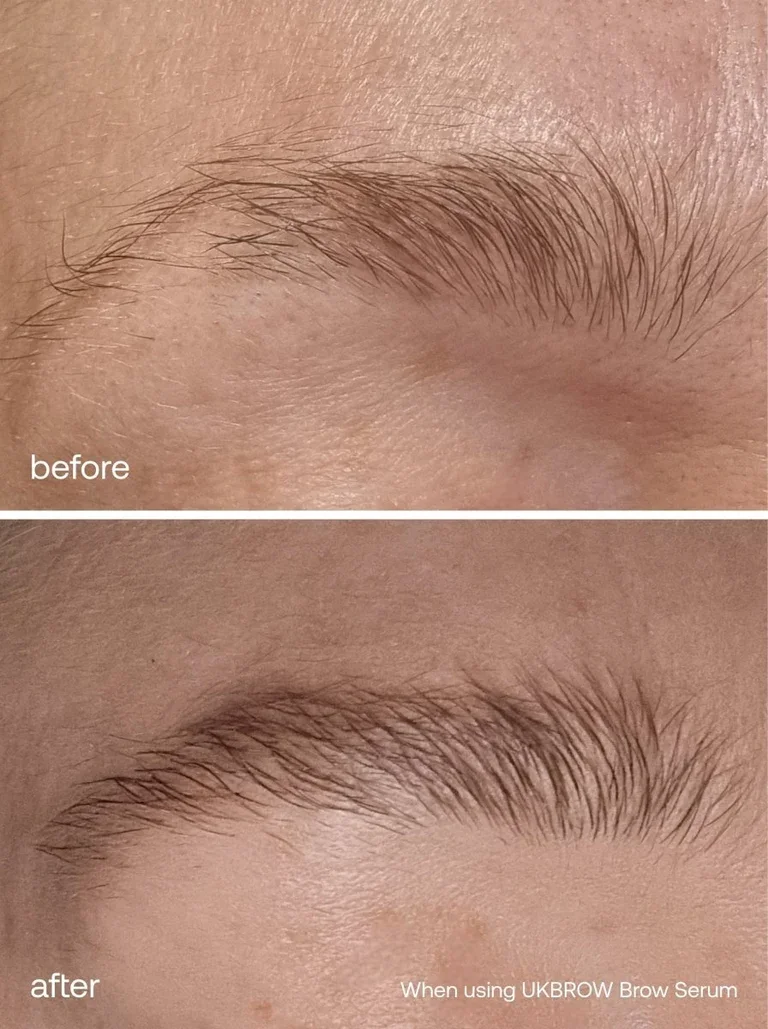lash-growth-serum-eyebrow-growth-serum-set-uklash-uklash-ukbrow-set-8019840.webp