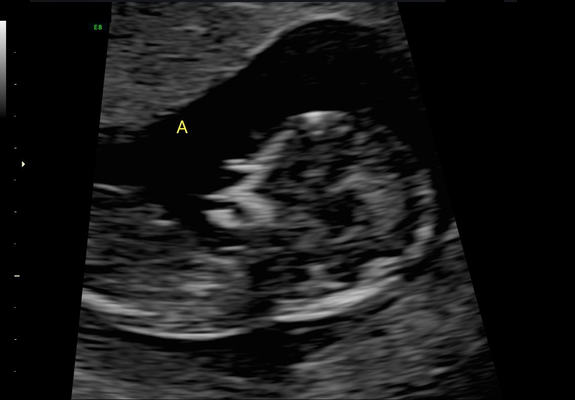 Baby girl Charlotte