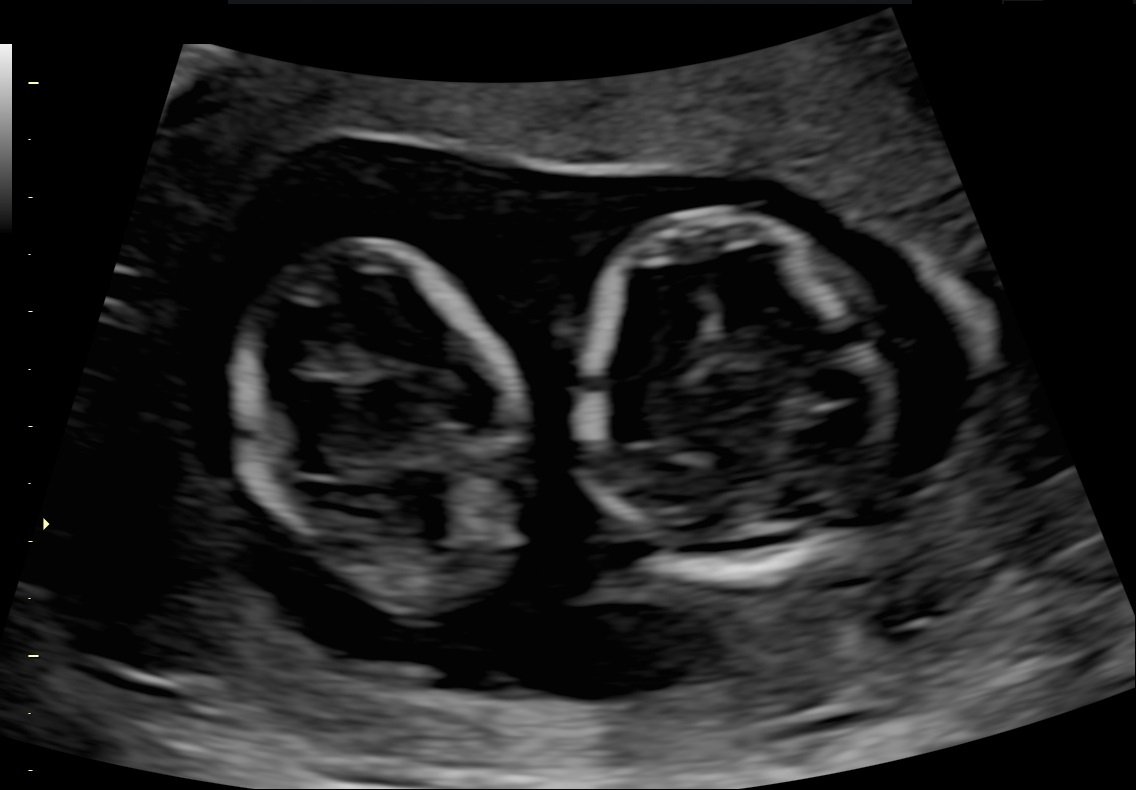 Here they are side by side in mommy's assembly line tummy! Mommy runs a tight ship! You better behave and stand at attention when the camera comes!