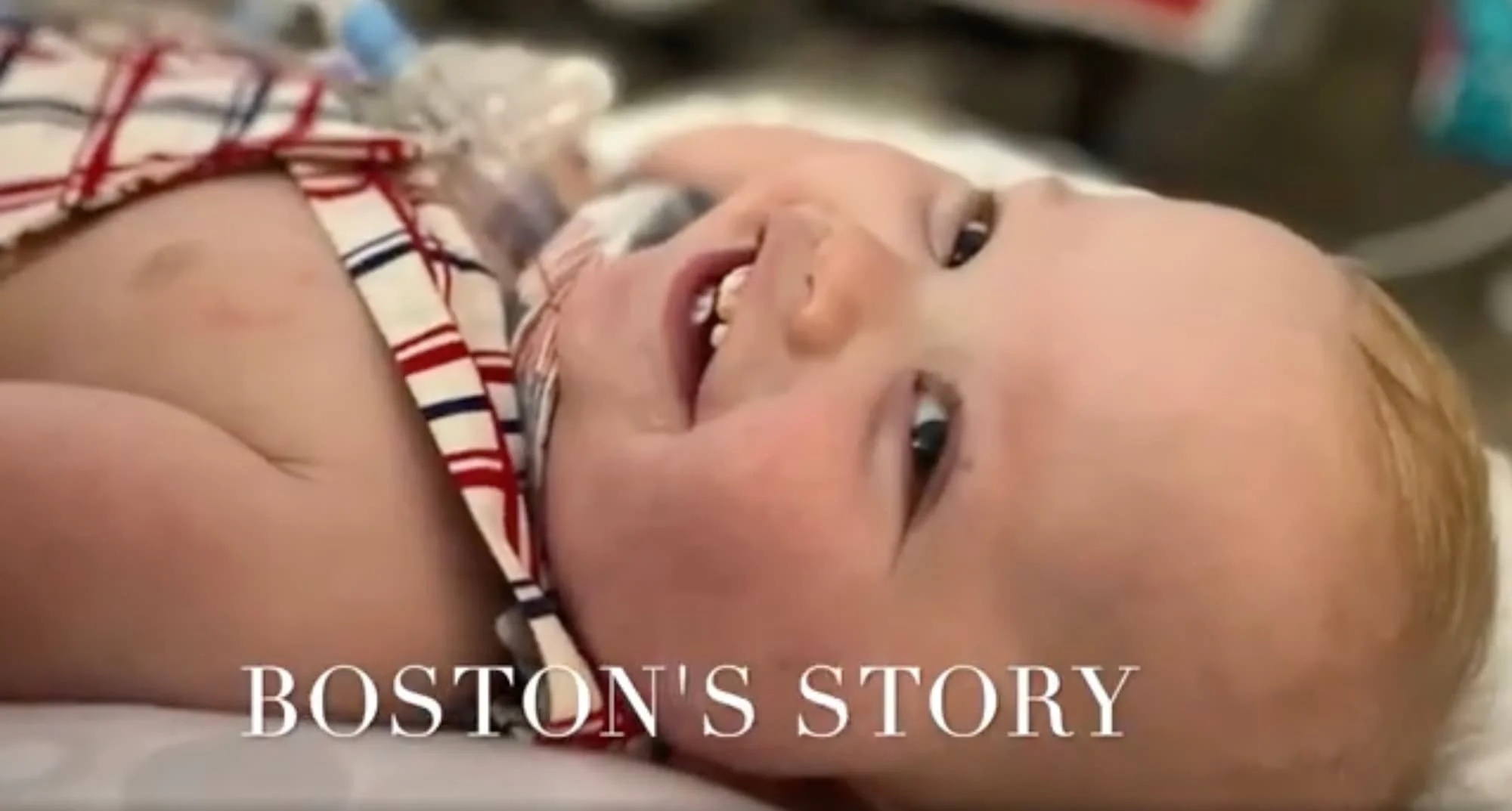 Boston’s Type 4 Laryngeal Cleft Journey