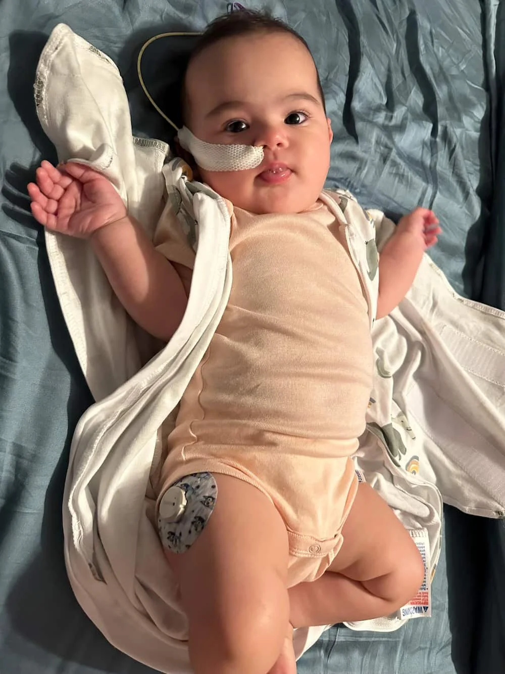 Olivia glucose monitor.jpeg