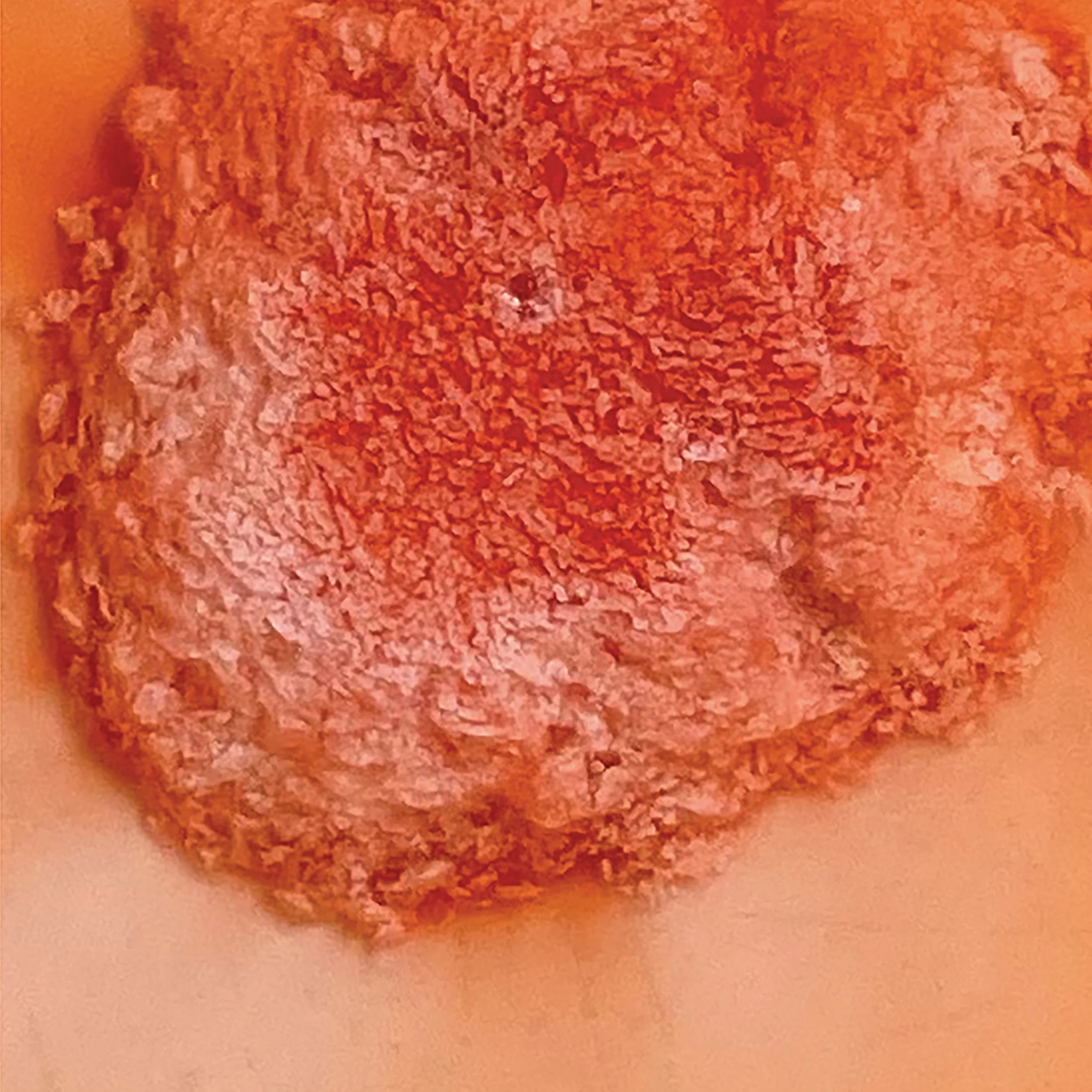 The American Pain Killer, 2022
50 Pills of Tylenol 500 in water, 24x24 in