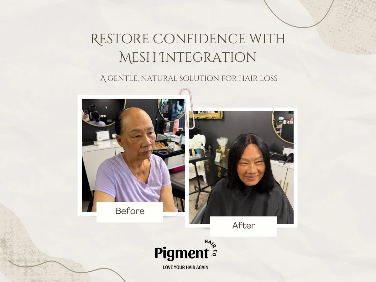 Restore Confidence with Mesh Integration: A Gentle, Natural Solution for Hair Loss