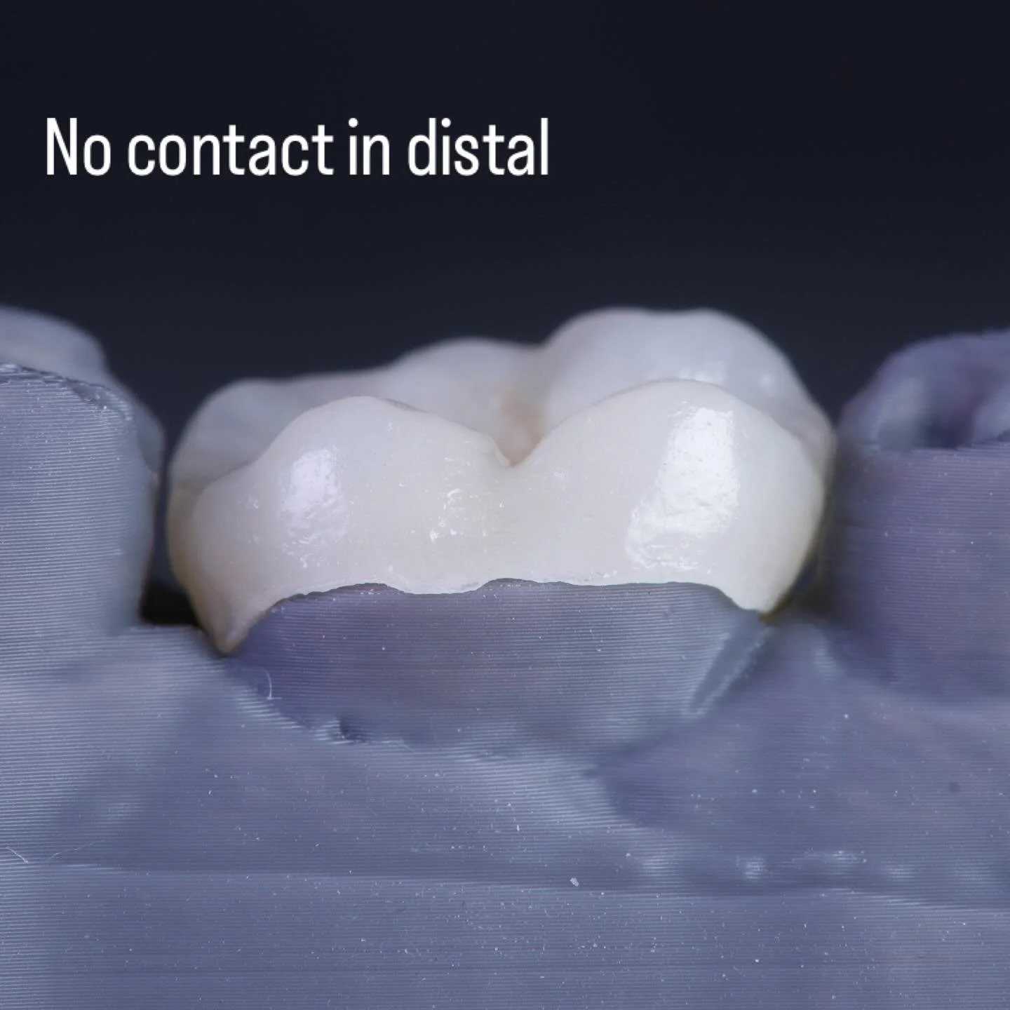 Another case where we compared the accuracy of between FDM and SLA printing and where&hellip; FDM was more accurate. We were not expecting that with our technician to be honest. I know this is just one case, and there are many parameters to consider 