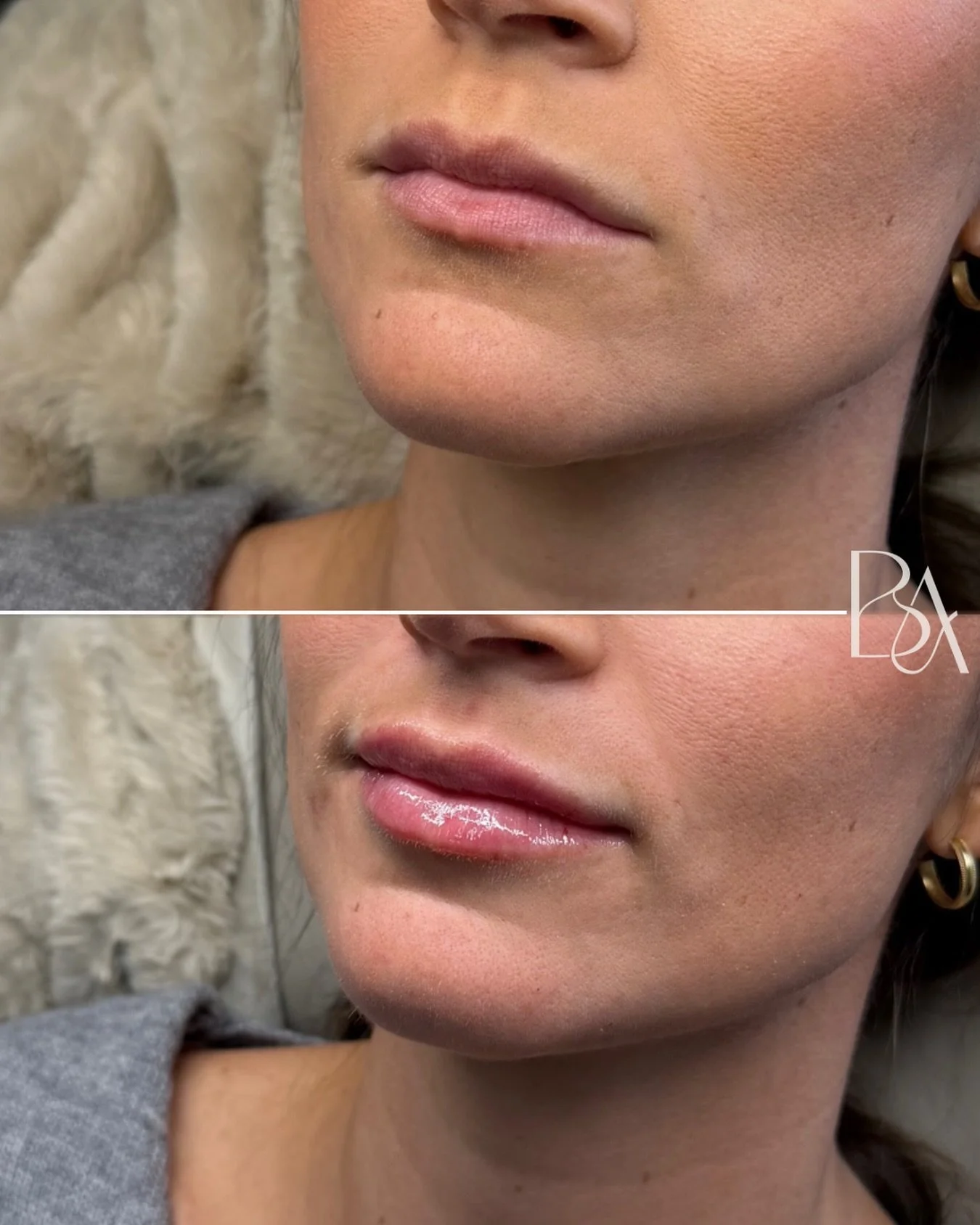 Soft, Balanced, &amp; natural&hellip; how it should be. 👌🏾🤎

📍Beige Atelier| Annapolis, MD
💉@injectorsteph.o

#naturallips #annapolismedspa #beigeatelier #injector #naturalresults #lipfiller #dmvlipfillers