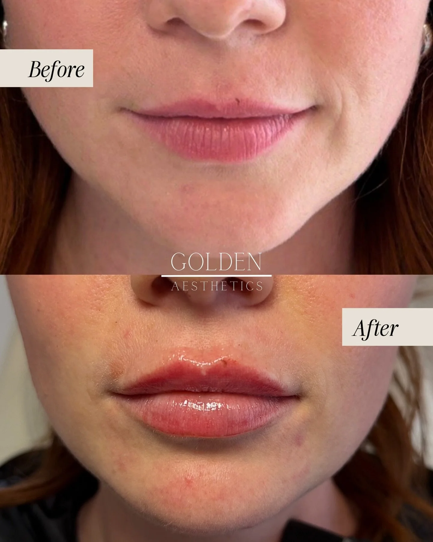 Okay slayyyyy 🪄💋

This angel came in wanting a little extra shape &amp; soft definition. We added gentle volume and refined her borders to bring out the features she already had.

Polished and balanced, but still natural-looking! Truly a chef&rsquo