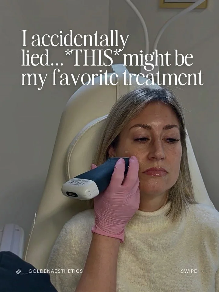 Okay, okay I know I just said our new Signature Golden Biostimulation was my favorite service&hellip; but how do you pick a favorite child?!

Our Signature Golden Facial Balancing is our signature filler service that evaluates your face as a whole, m