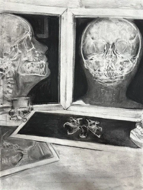 X-Ray, Charcoal, 16 x 30 inches, 2024