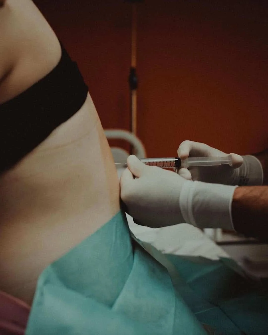 What Is an Epidural? A Complete Guide for Expectant Parents