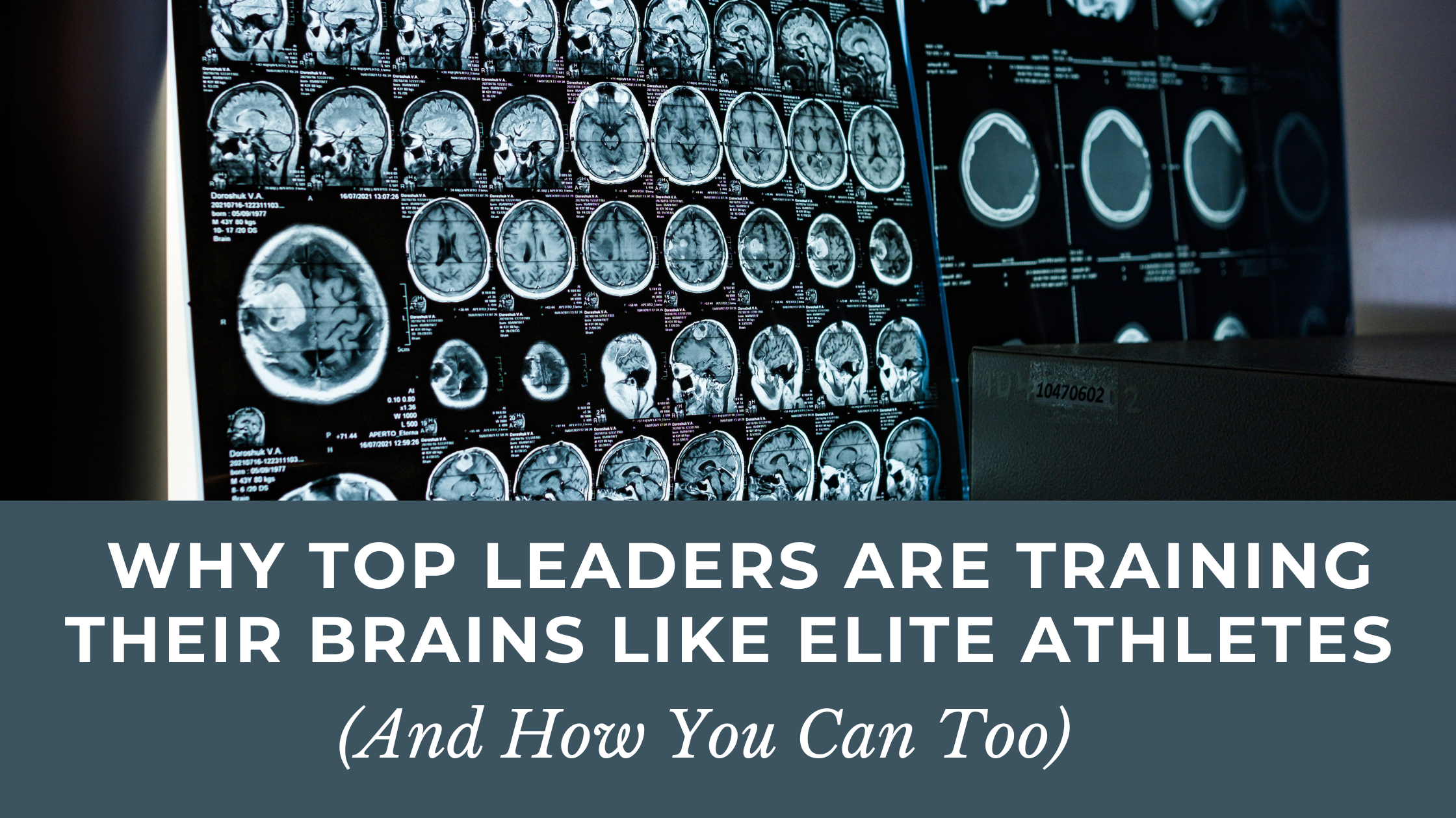 Why Top Leaders Are Training Their Brains Like Elite Athletes (And How You Can Too)