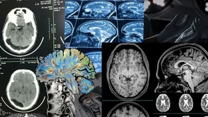 Leadership Agility: Navigating Uncertainty for a Global Professional Services Firm