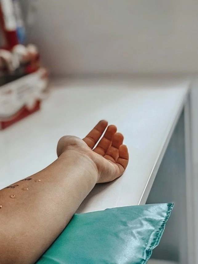 Allergy Skin Test Az Allergy