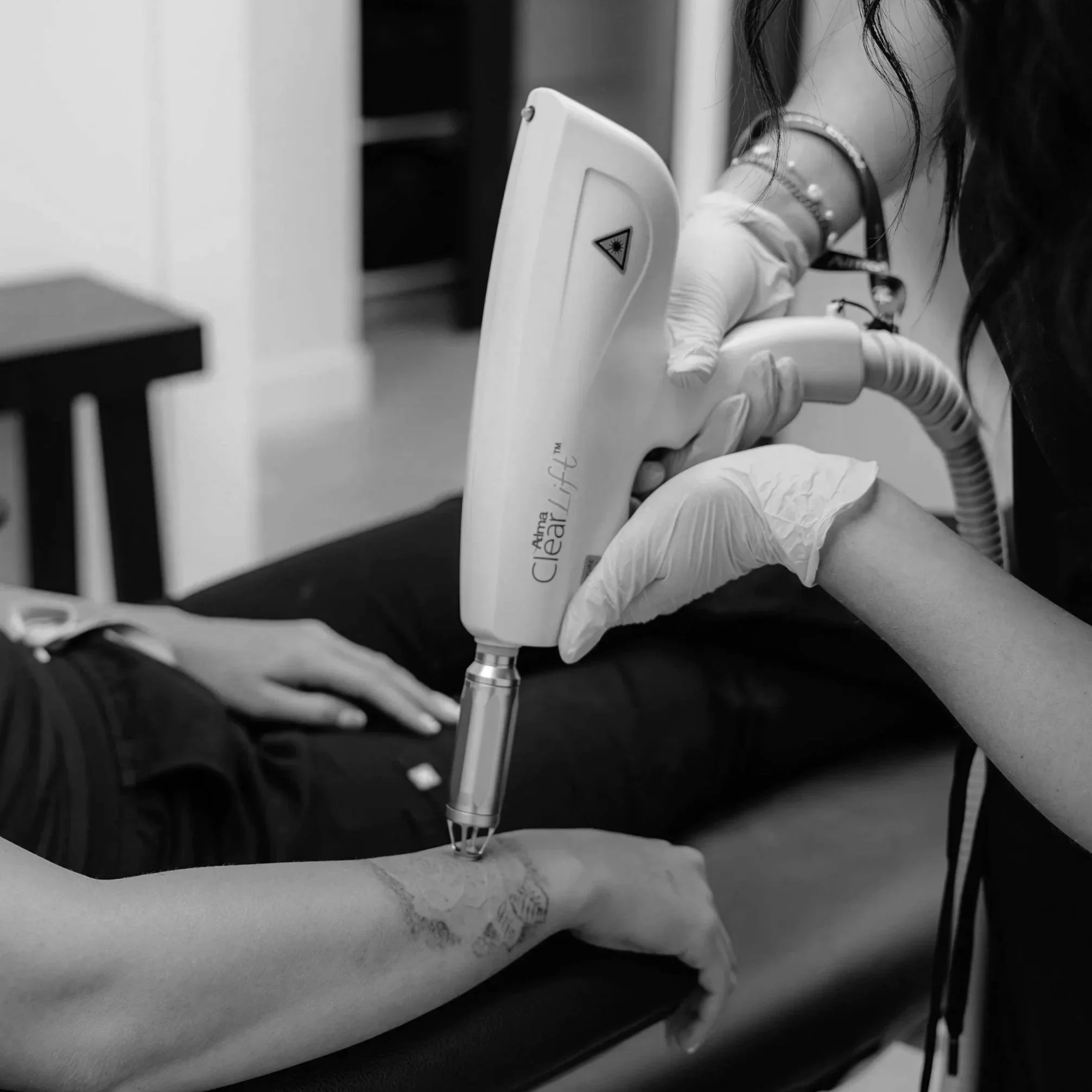 A person receiving a laser tattoo removal treatment on their forearm from a professional using a ClearLift device, wearing pink gloves.