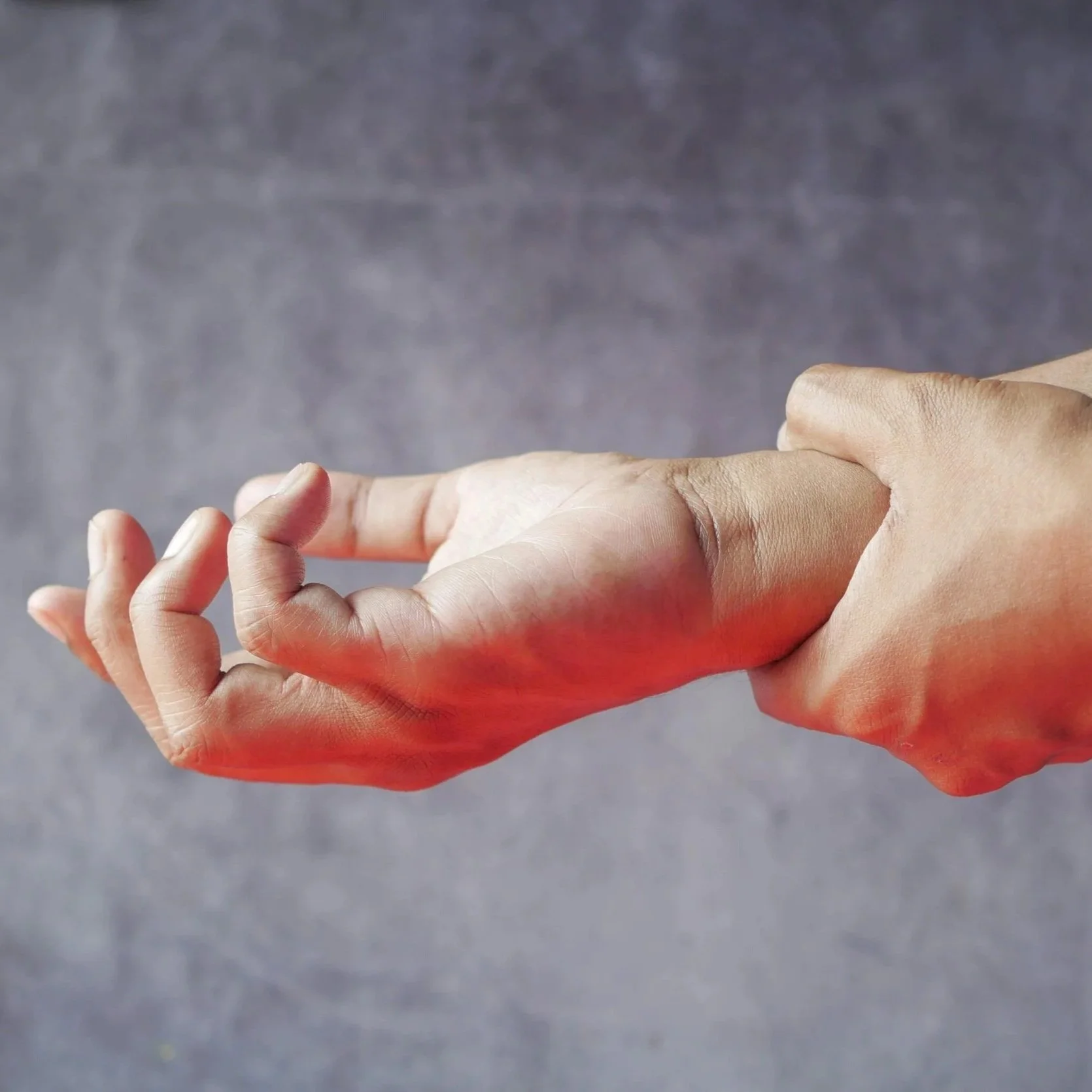 Thumbs Down: Carpal Tunnel Is Cramping My Style