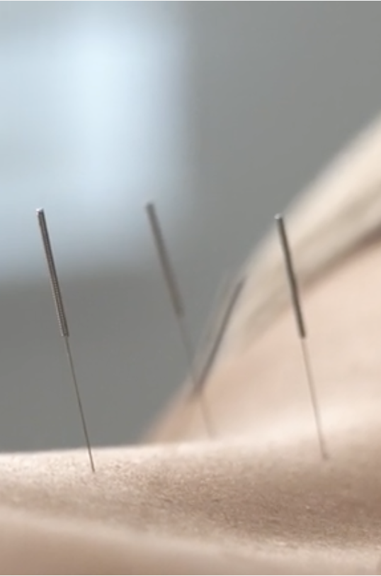 Nähen einer Lederfläche mit Nadeln.