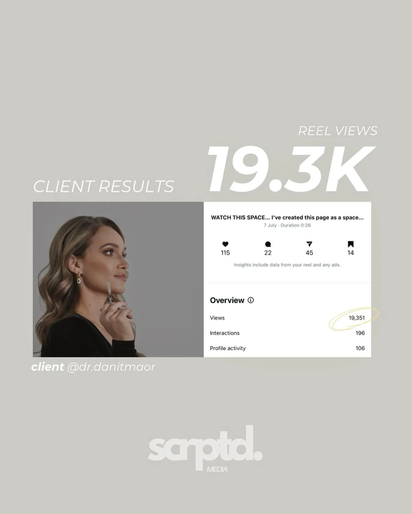 Incredible growth IN JUST ONE MONTH ✨&hellip;
 
Our amazing client @dr.danitmaor came to us with a vision of building her professional social media presence, and look at the results we&rsquo;re achieving together!
 
Just 30 days ago, Danit didn&rsquo