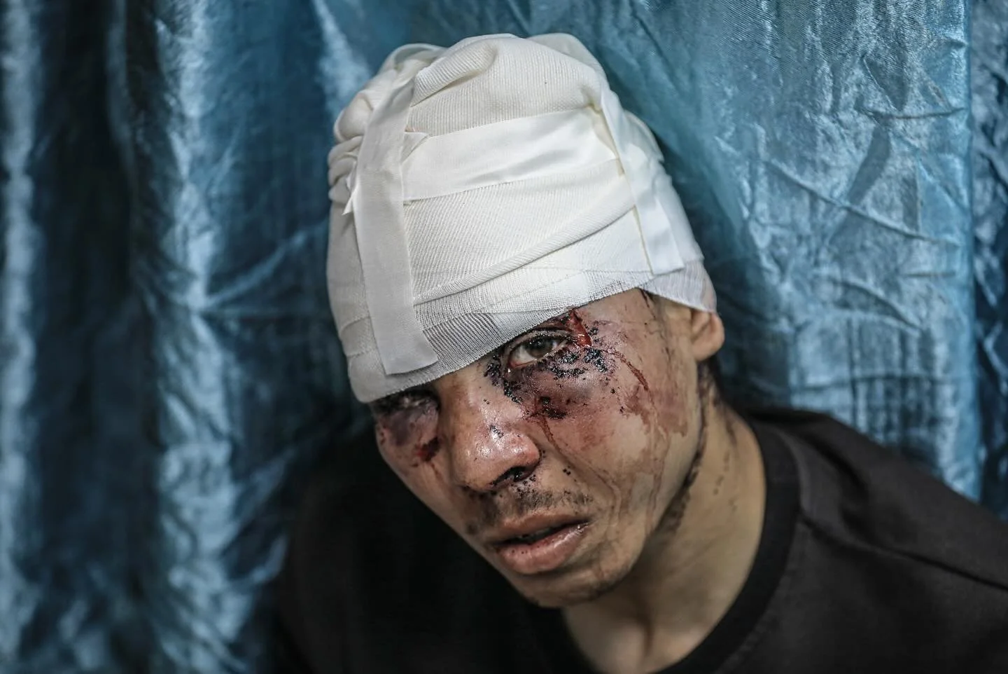 Open-source evidence documenting torture in Gaza