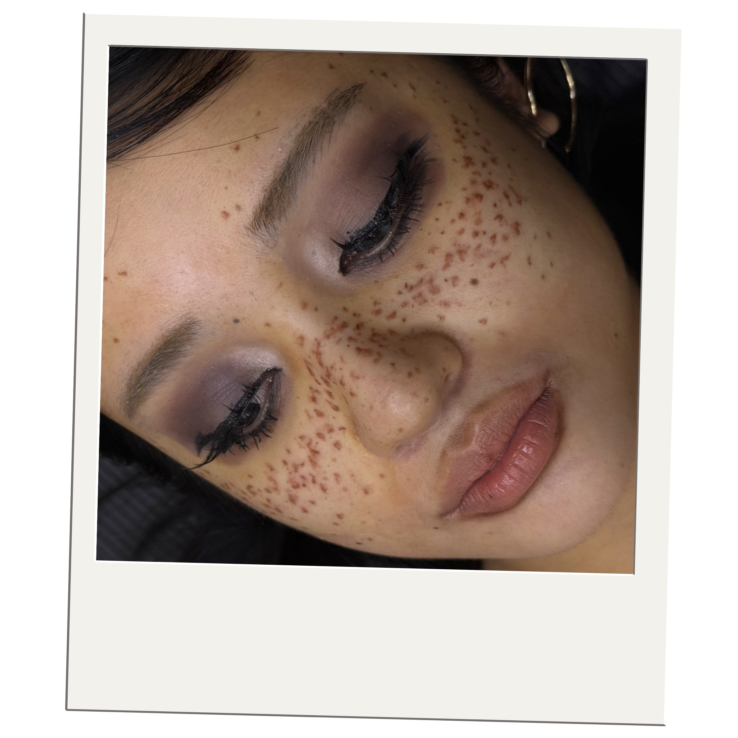 Freckles
