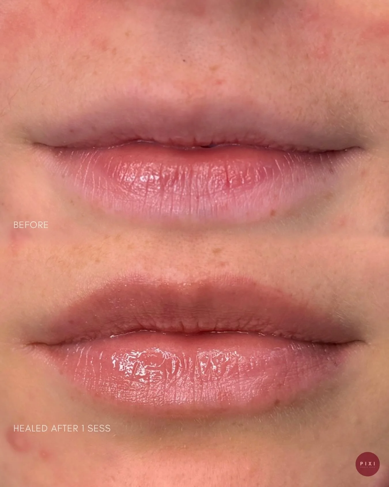 Your lips, but better 🤍 
Healed results like these after just one session of Lip Blush 🫰
Book a complimentary consultation and find out more.