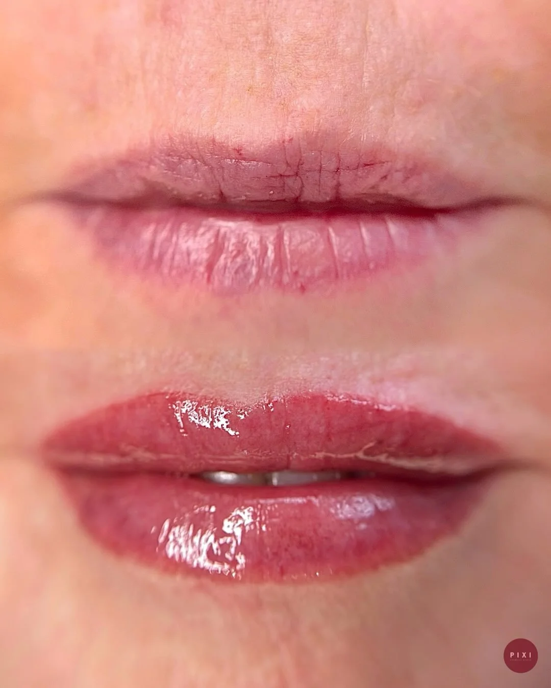 Restore natural definition and tone with Lip Blushing,
Perfect for all lips: mature, sun-damaged, pale or any shape ✨
Located 417 Chapel Street South Yarra
0466224624