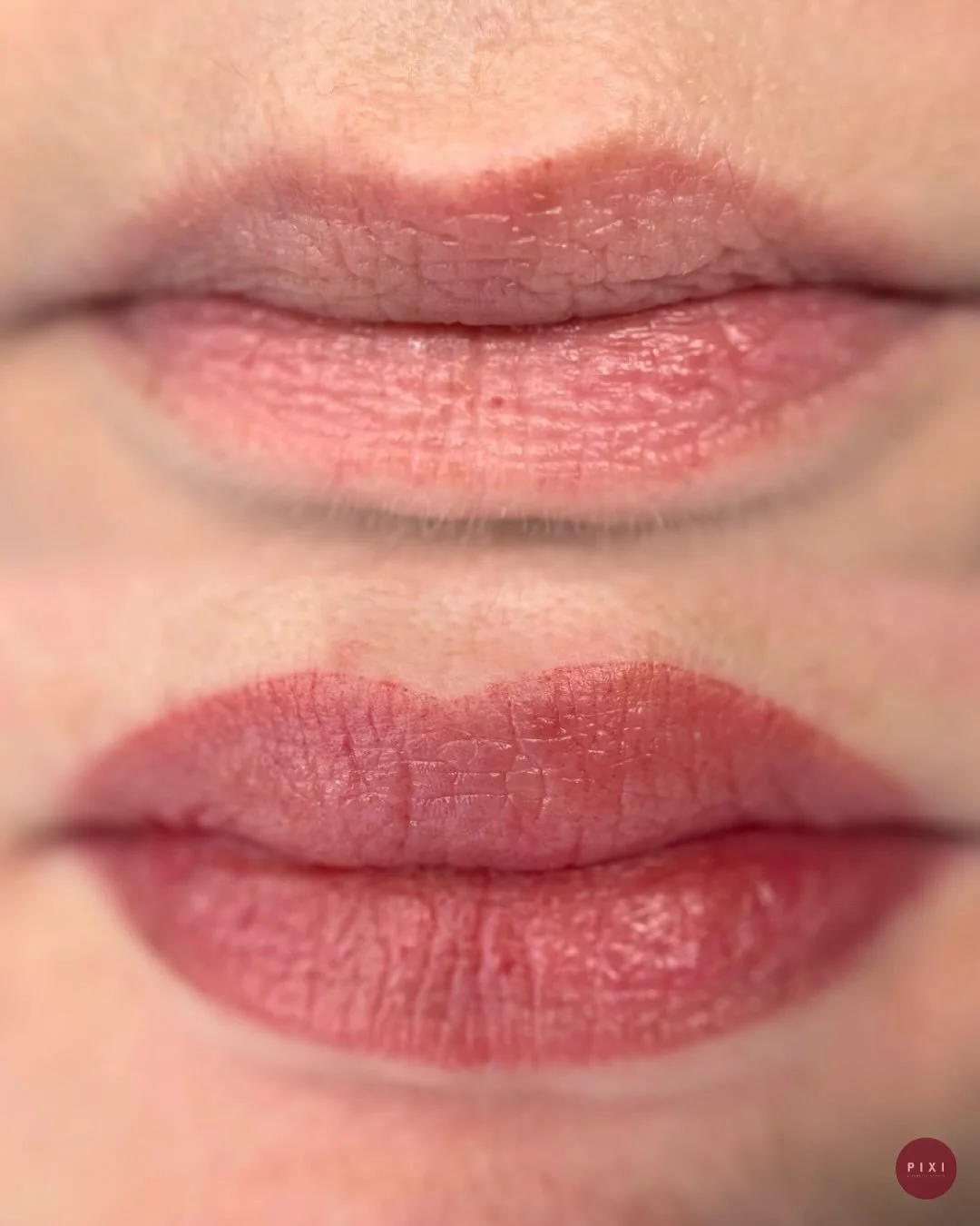 Signature lip blush treatment.
This technique restores lost definition, corrects uneven tone and enhances the natural shape, without looking overdone.
Suitable for all skin types, including those with fine lines and volume loss. Results heal around