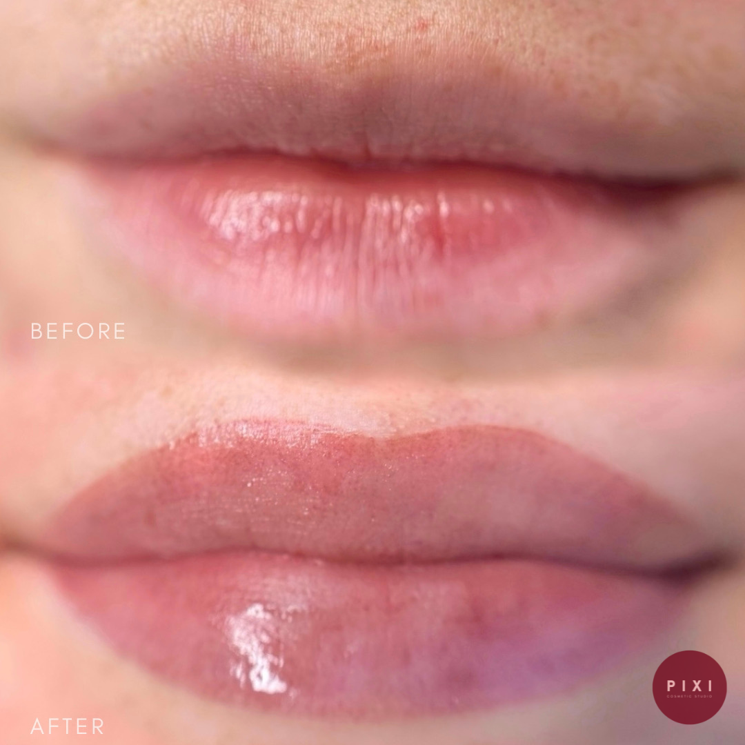 Befor Lip Blush.png