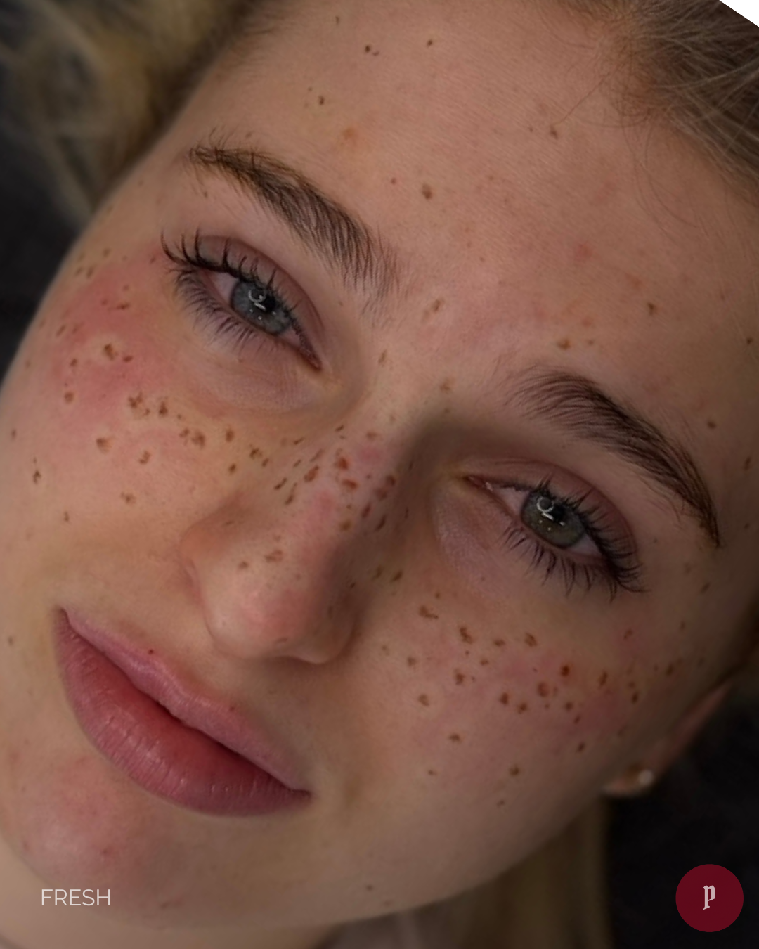 natural freckle
 tattoo melbourne