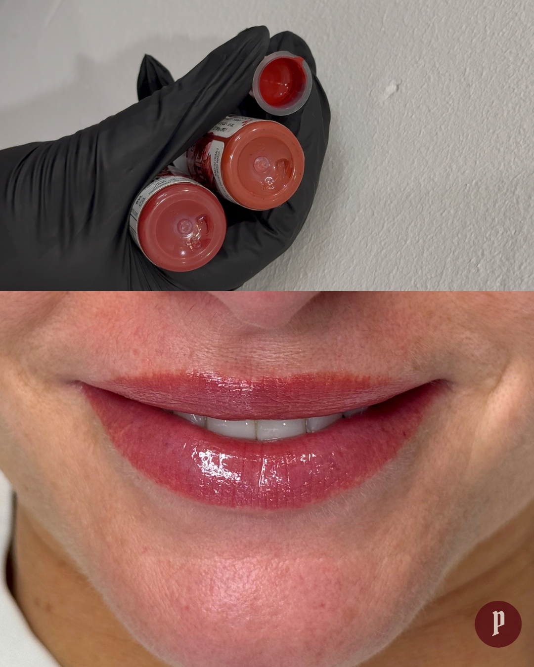 B&A'S (5).png