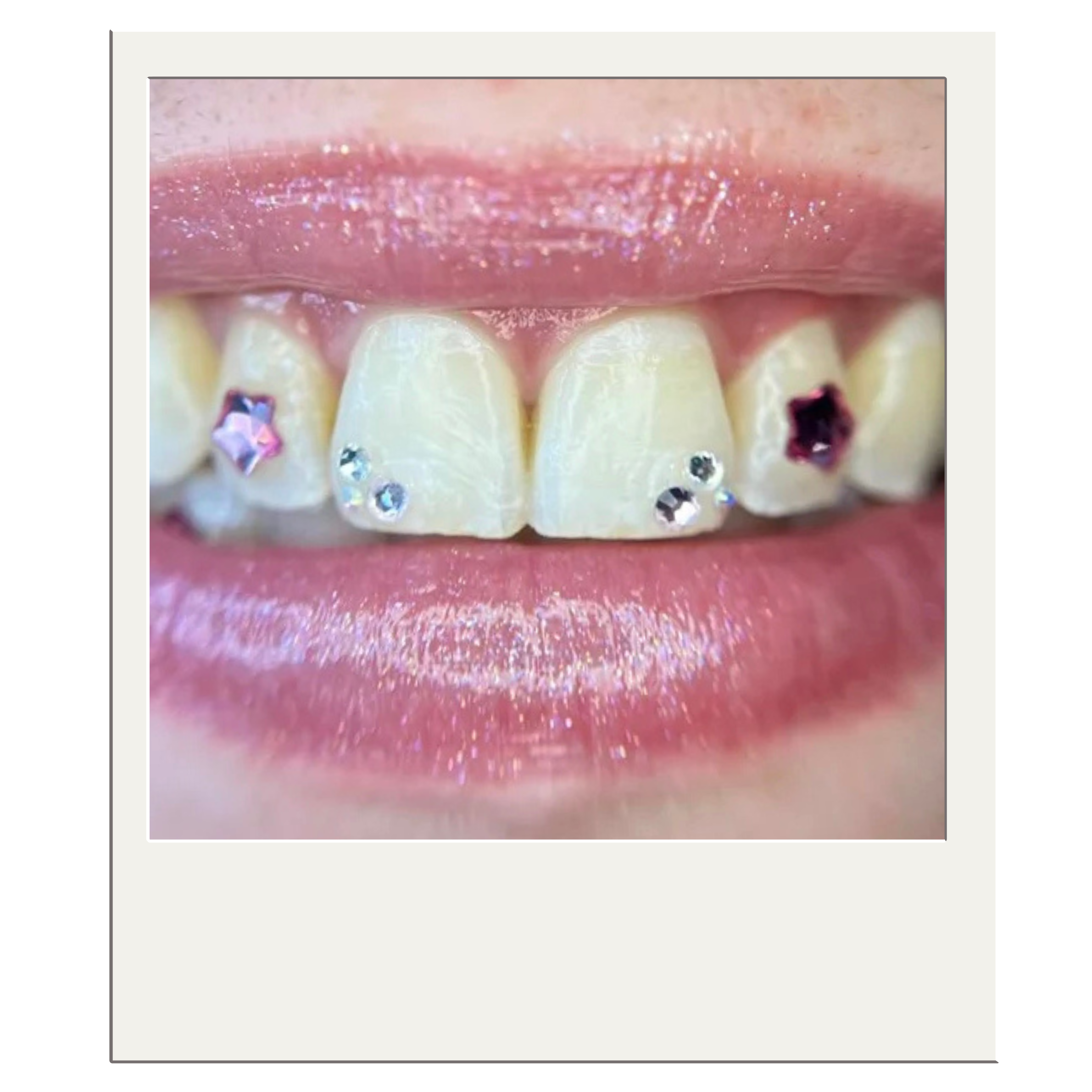 Tooth Gems