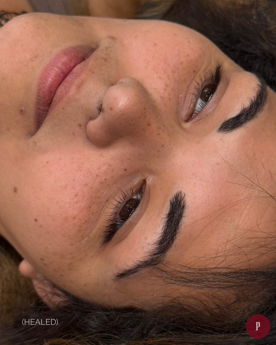 healed freckle tattoo melbourne
