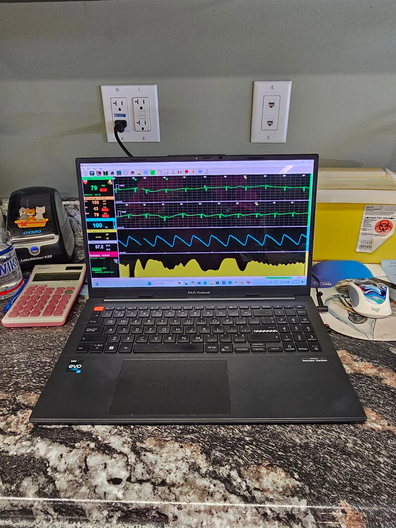 A laptop displaying medical monitoring data, wires connected to the laptop, a calculator, a tissue box, a mouse, and medical supplies on a granite countertop in a clinical setting.