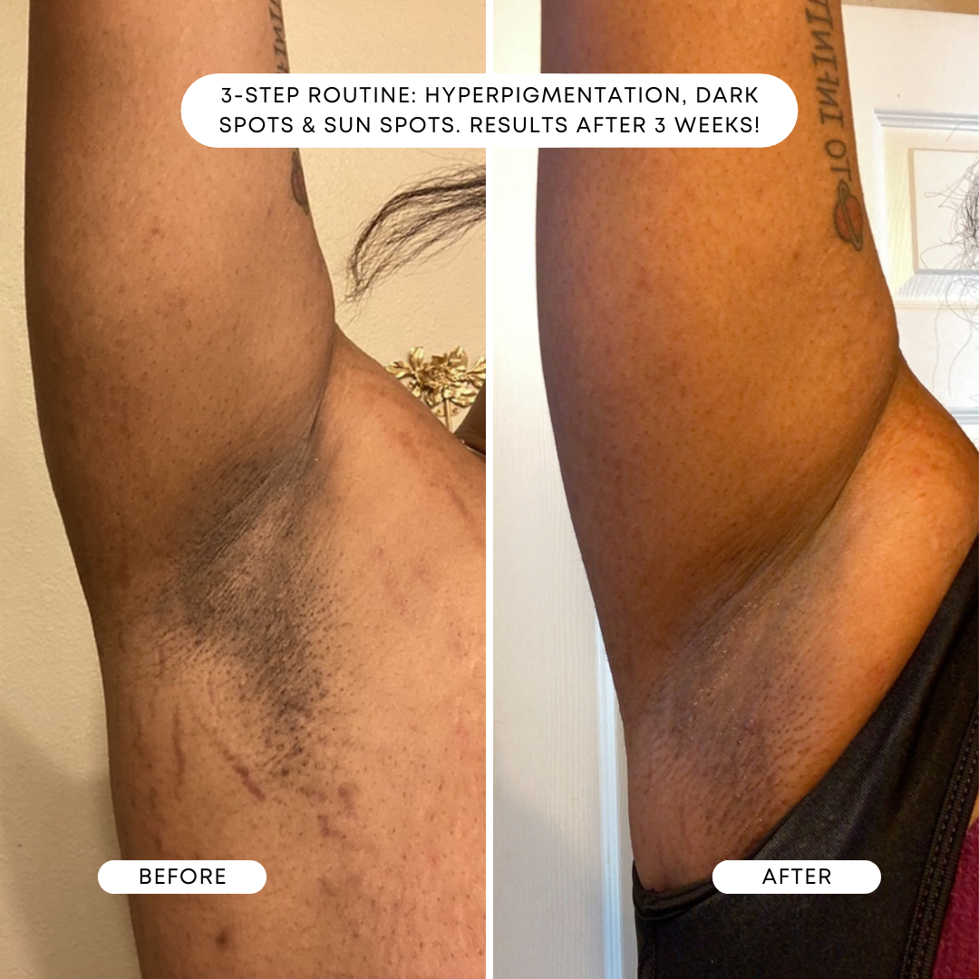 BermudaBeforeandAfter_f2c2c941-2fec-4efa-b6a5-8312b24cd20e.png