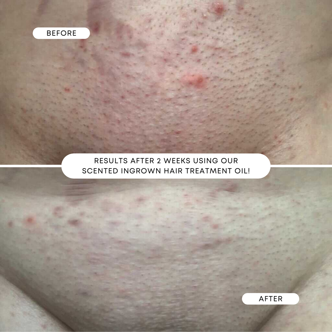 SweetEscapeBeforeandAfter_0d72bda0-3937-4bf9-94e5-2abf4a9ed5fe.png