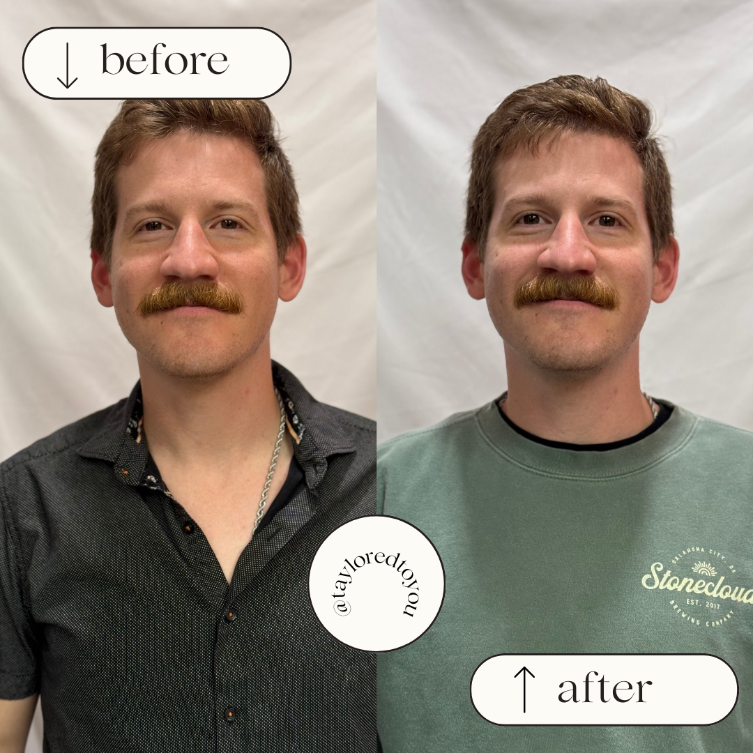 beforeafter template (1).png