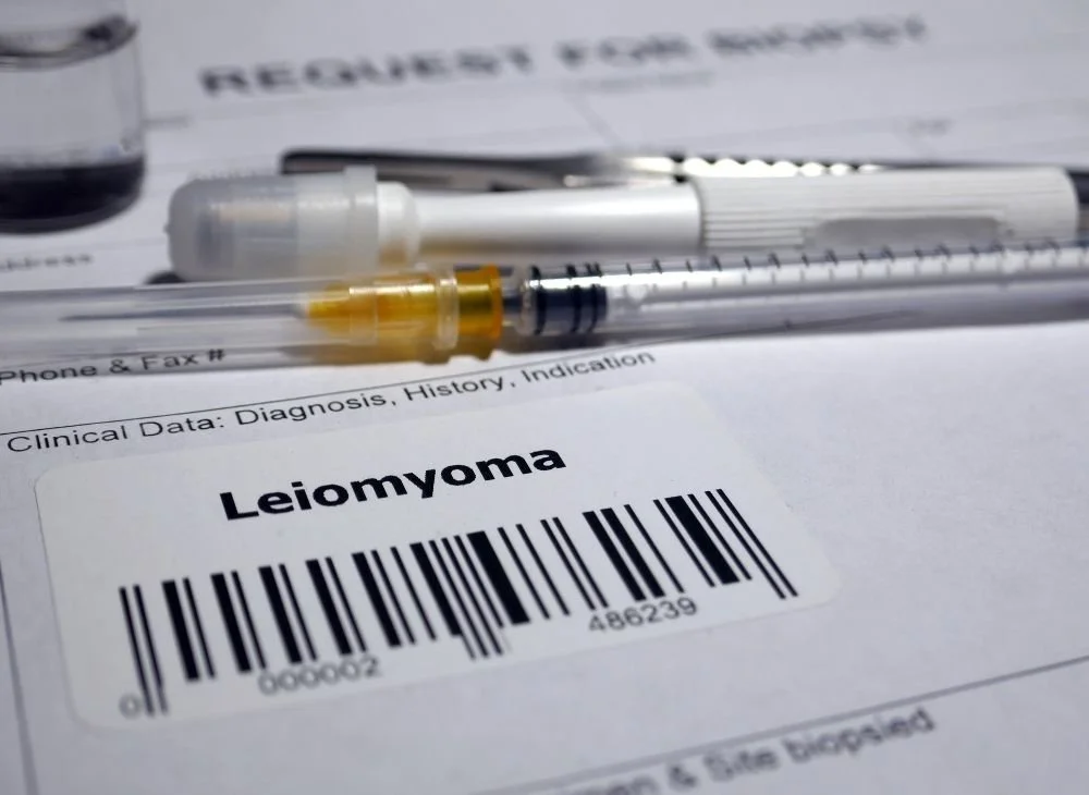 What should everyone know about fibroids