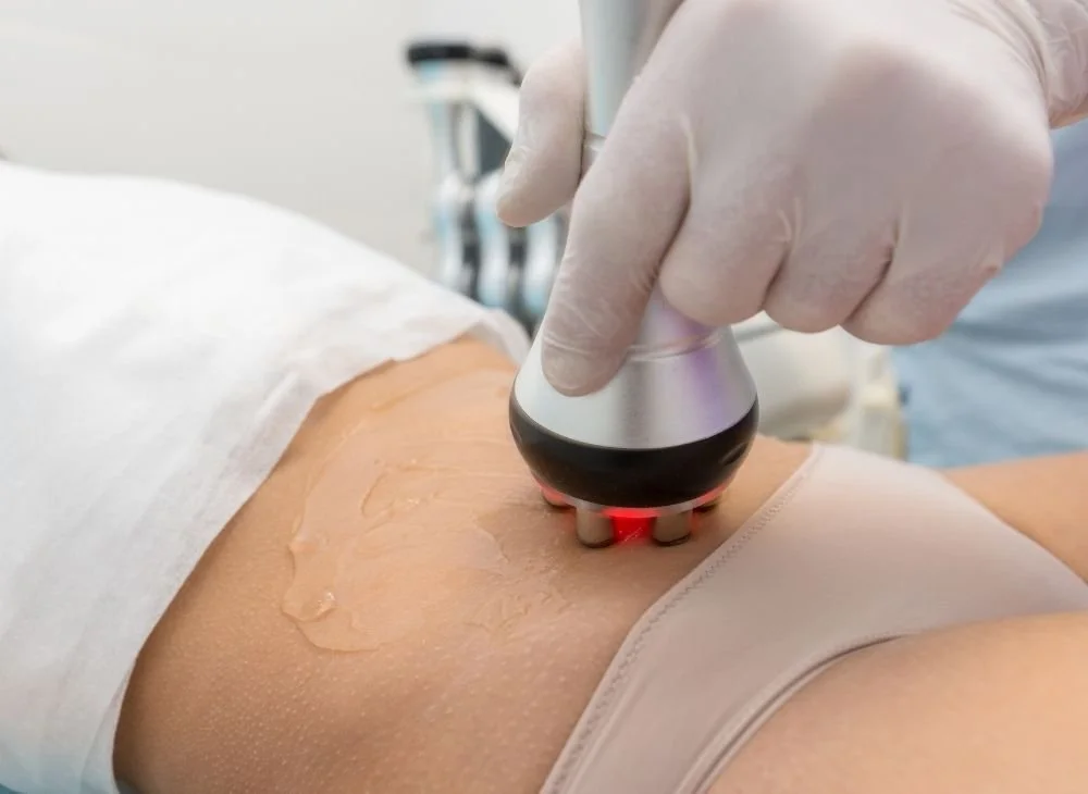 How does a radiofrequency ablation for fibroids work?