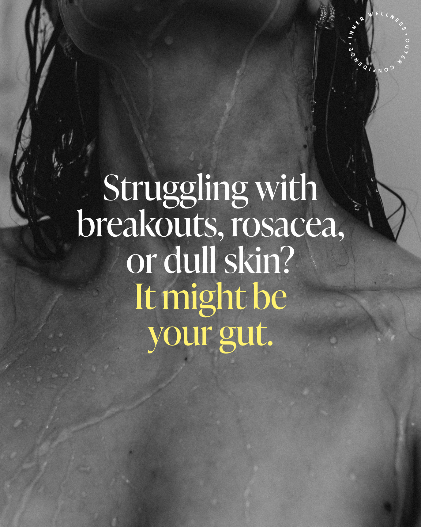 Educational Post_ “The Gut–Skin Connection.png