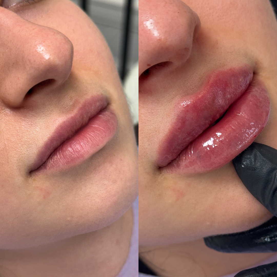 Untitled design.zip - 3.PNG