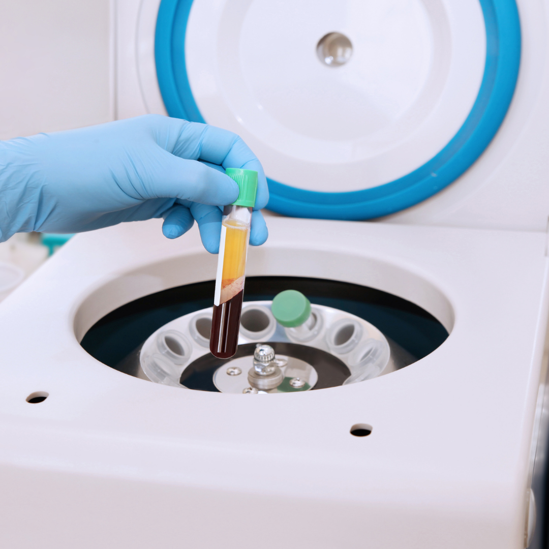 PRP Injections — Horizon Joint and Wellness