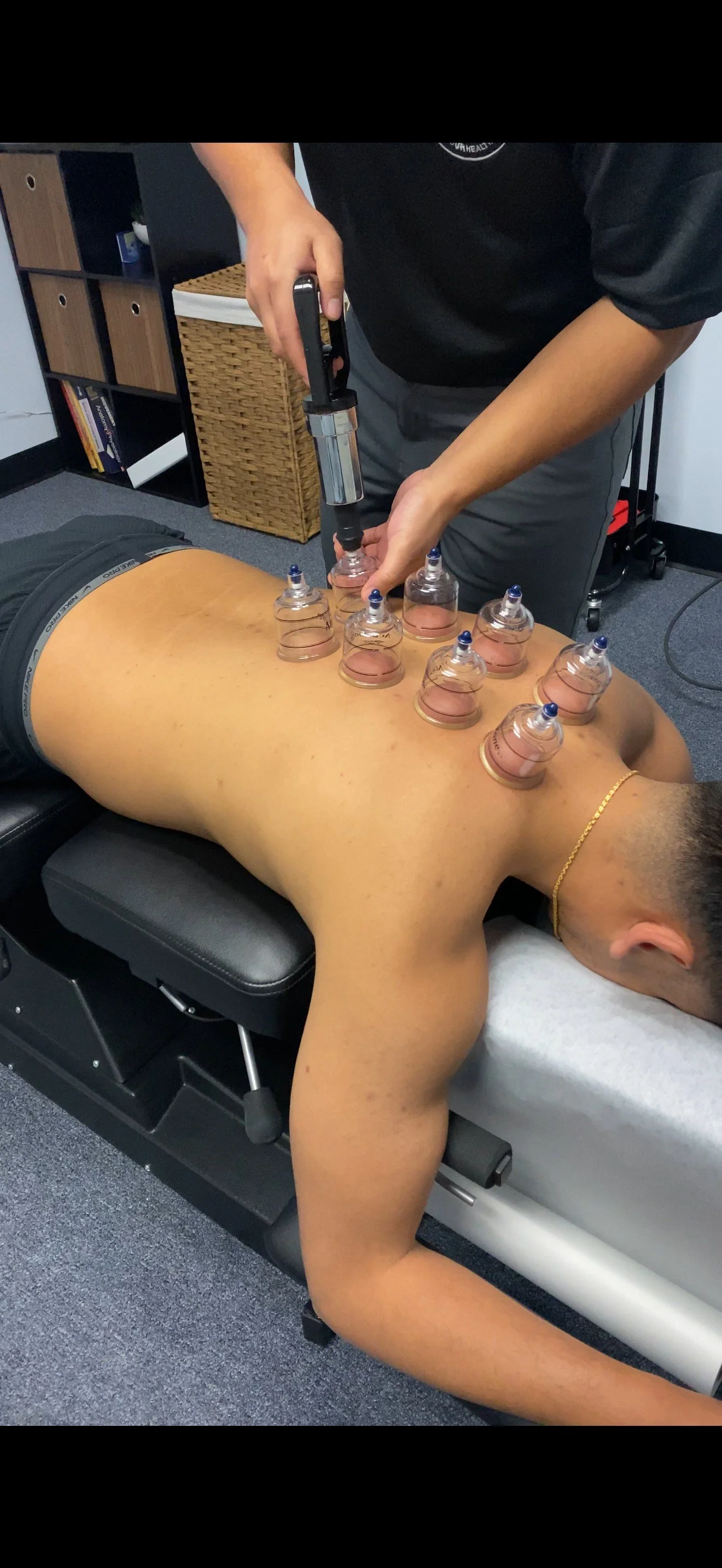 sidekick-chiropractic-irvine-ca-action-cupping-01.jpg