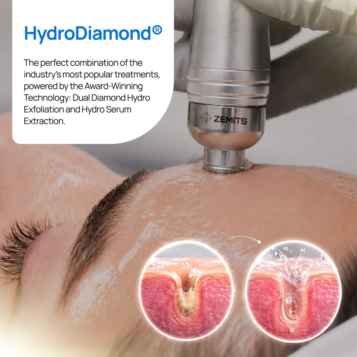 hydrodiamond-banner.webp
