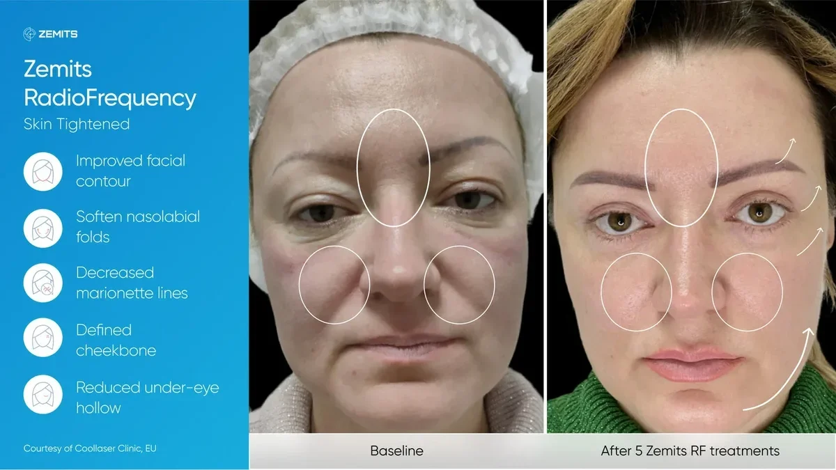Facial_Technologies__jpg.webp