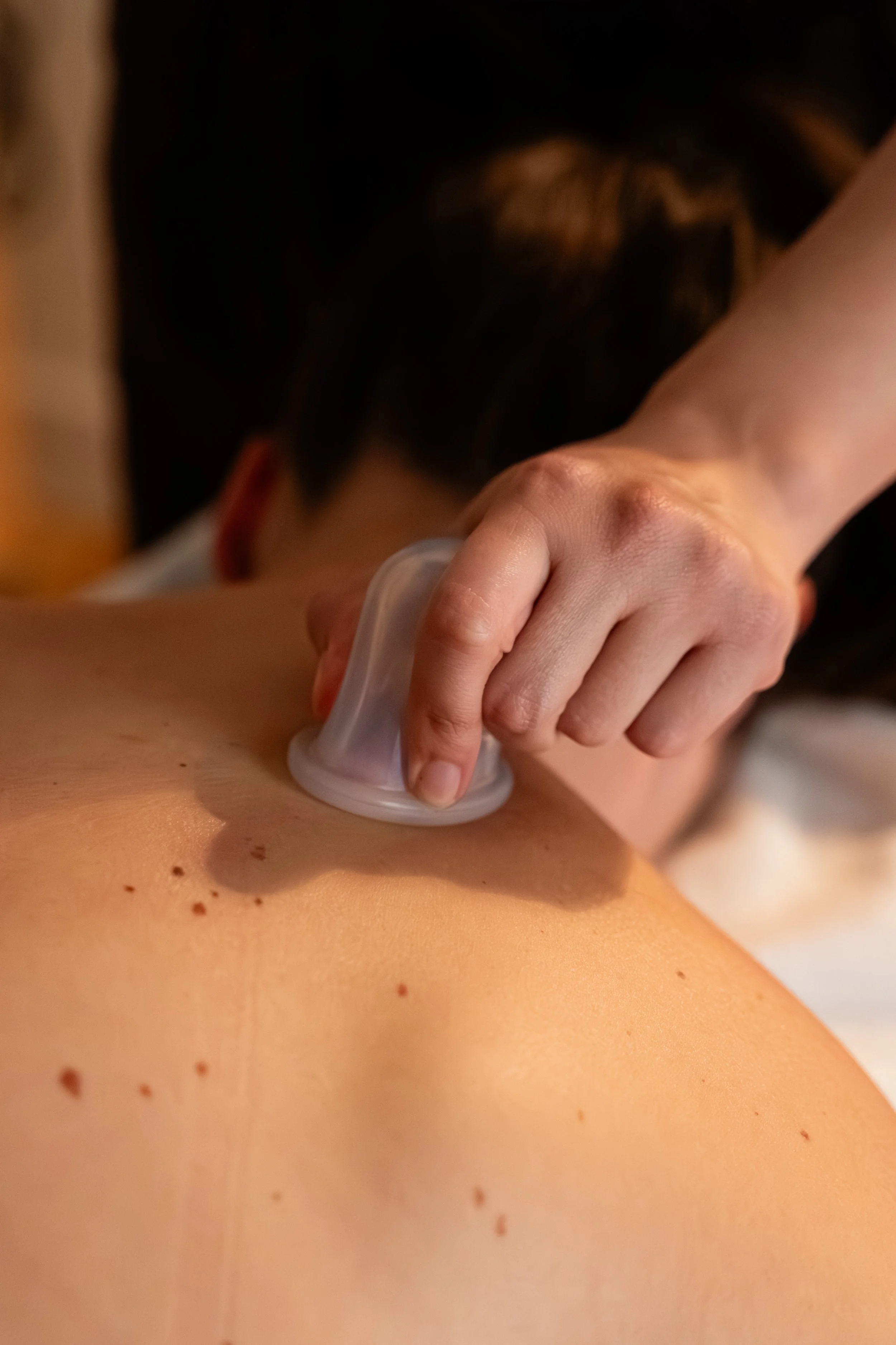 Massagem terapêutica nas costas com ventosa no Plenum Studio