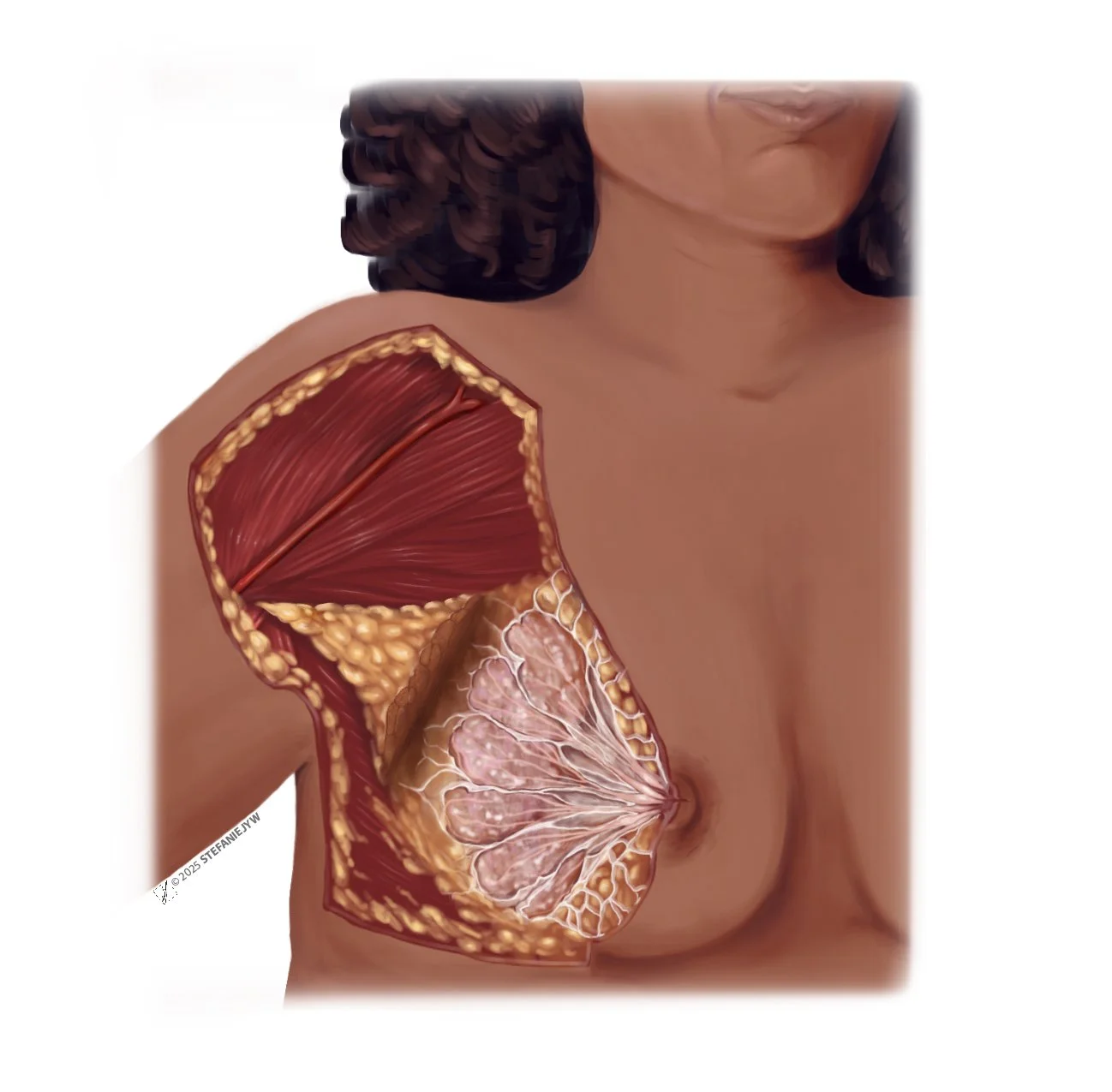 Illustration of the suspensory glands and the axillary tail of the breast