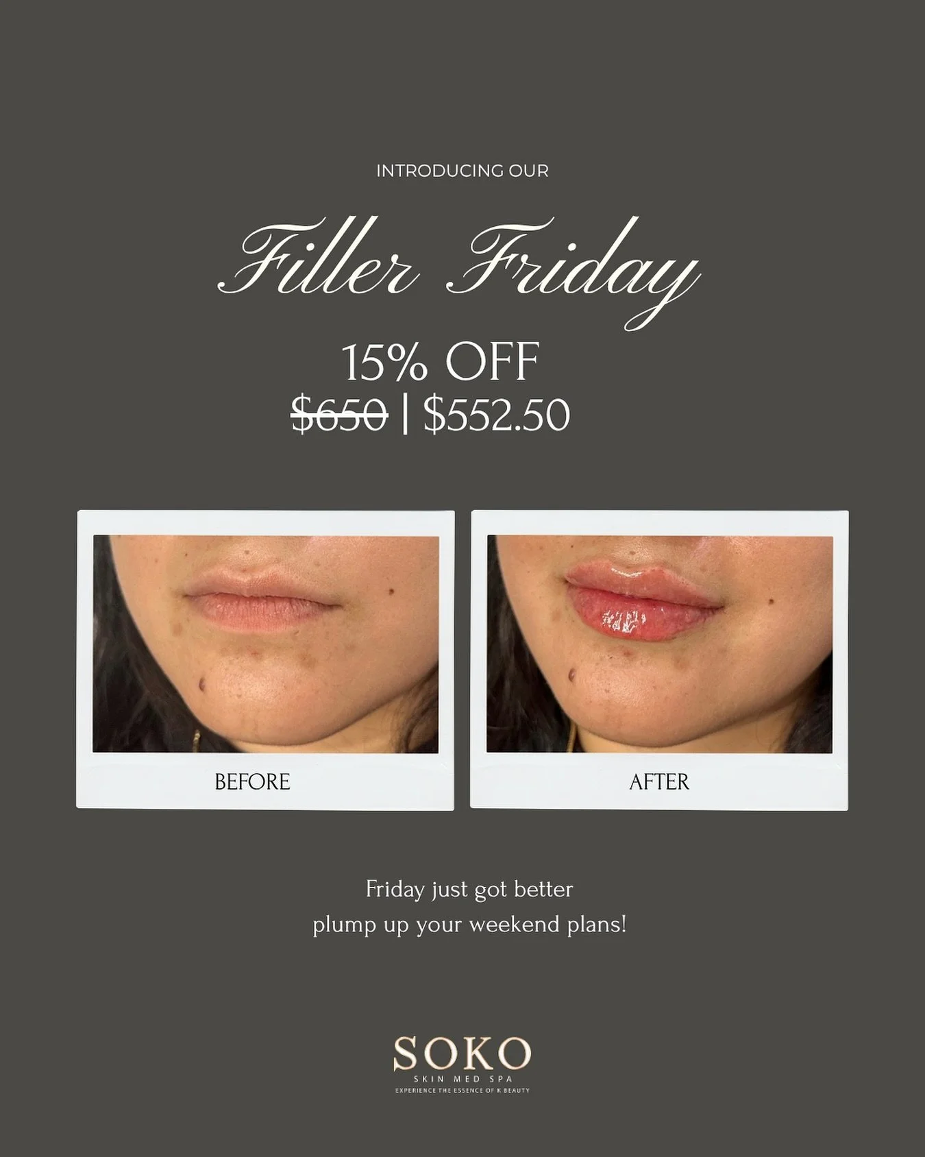 Enhance your natural beauty with confidence 💋
Glow into the weekend with 15% off lip filler every Friday!

 Our lip filler treatments are designed to refine, not redefine &mdash; giving you balanced volume, hydration, and symmetry while keeping your