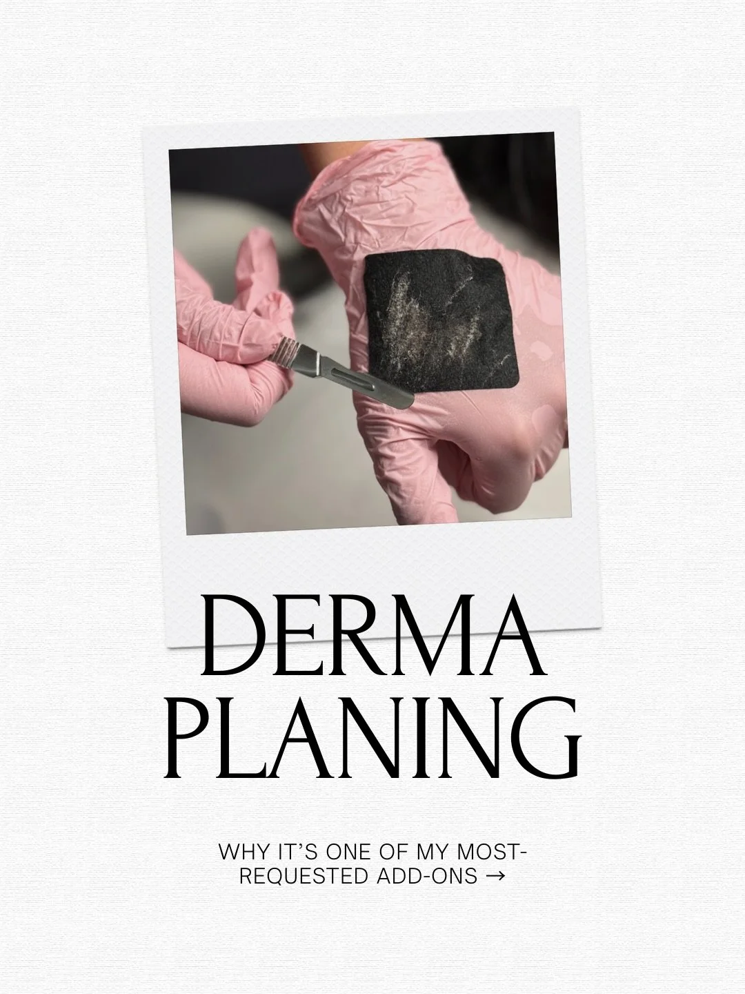 At Soko Skin Med Spa dermaplaning is one of our favorite add-ons for a reason. It&rsquo;s a simple, effective way to refresh the skin, enhance results, and elevate your treatment experience &mdash; with no downtime and immediate payoff✨🙂&zwj;↕️
some